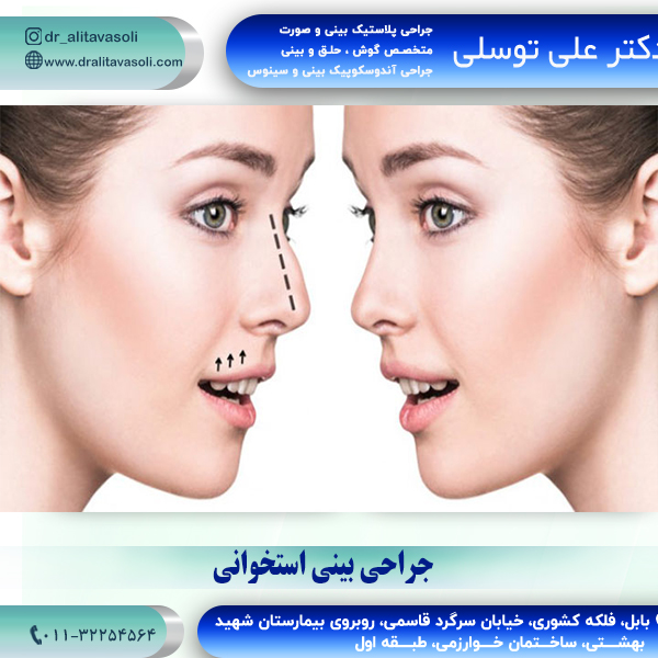 جراحی بینی استخوانی