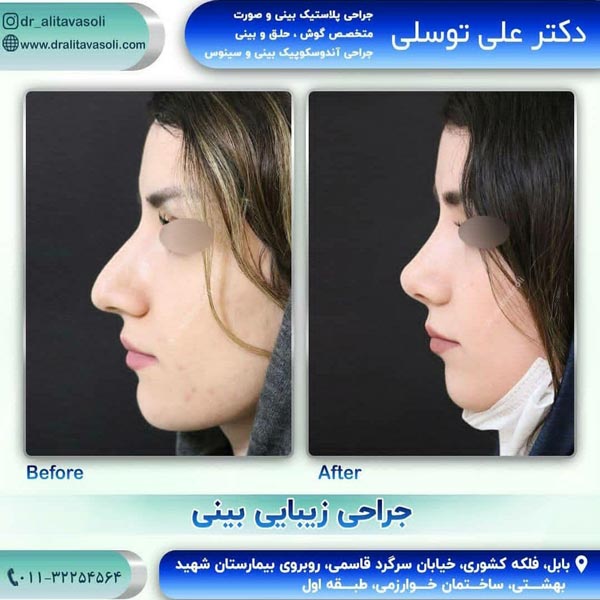 جراح بینی