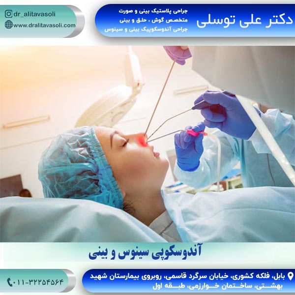 جراحی آندوسکوپی سینوس و بینی