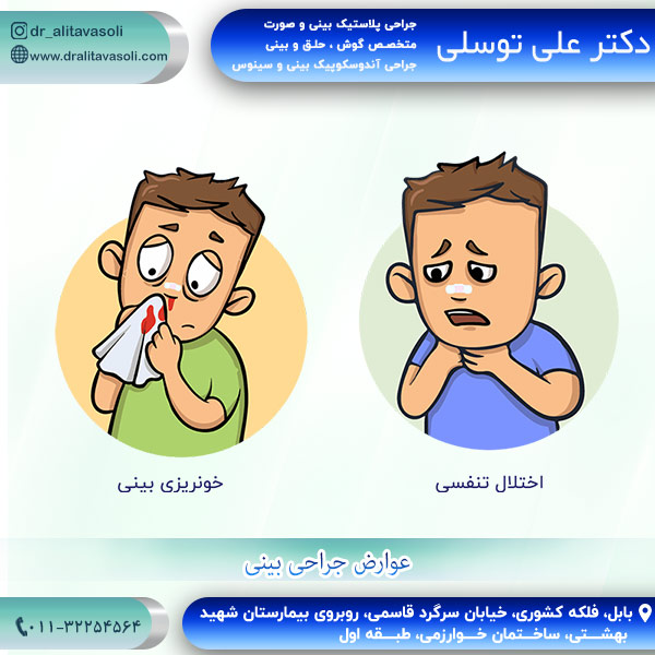 جراحی بینی