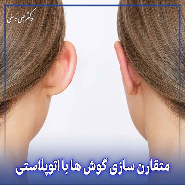 اتوپلاستی - دکتر علی توسلی