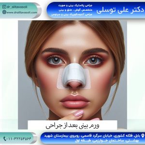 ورم بینی بعد از جراحی - دکتر علی توسلی