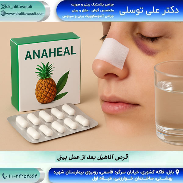قرص آناهیل بعد از عمل بینی