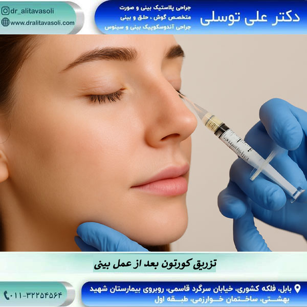 تزریق کورتون بعد از عمل بینی