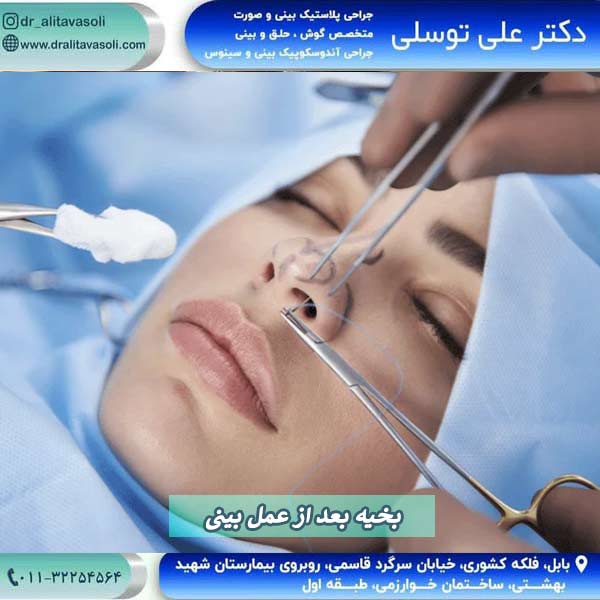 بخیه بعد از عمل بینی