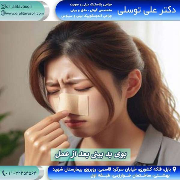 بوی بد بینی بعد از عمل - دکتر علی توسلی