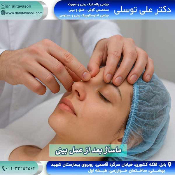 ماساژ بعد از عمل بینی - دکتر علی توسلی