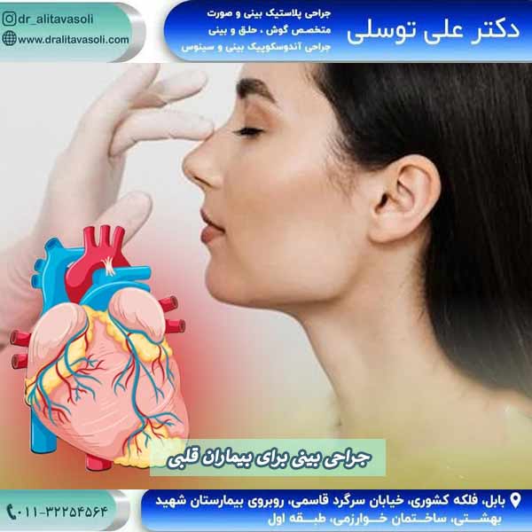 جراحی بینی برای بیماران قلبی - دکتر علی توسلی