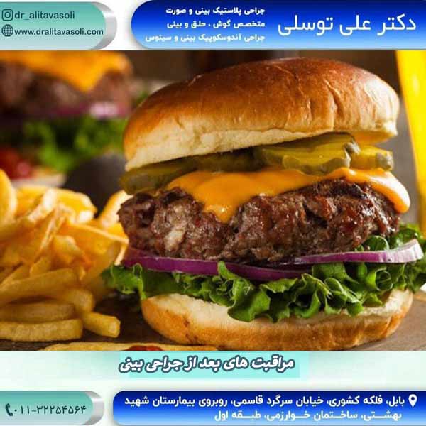 مراقبت های بعد از جراحی بینی
