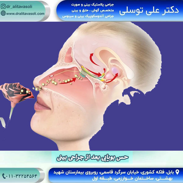 از بین رفتن حس بویایی بعد از جراحی بینی