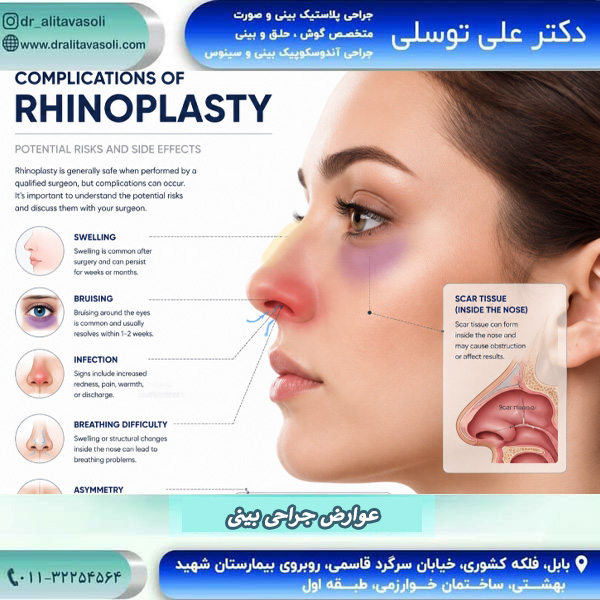 عوارض جراحی بینی