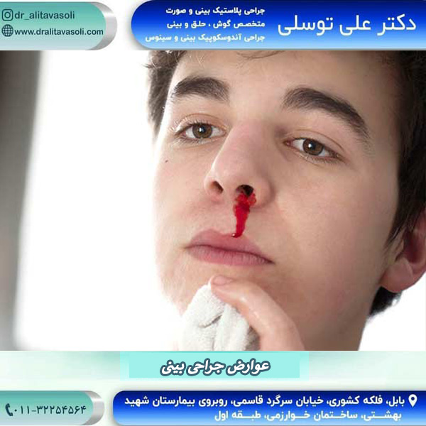 عوارض جراحی بینی