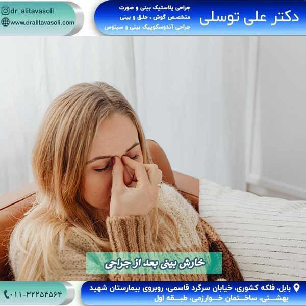 خارش بینی بعد از جراحی