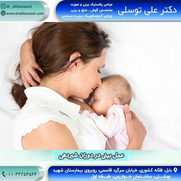 عمل بینی در دوران شیردهی
