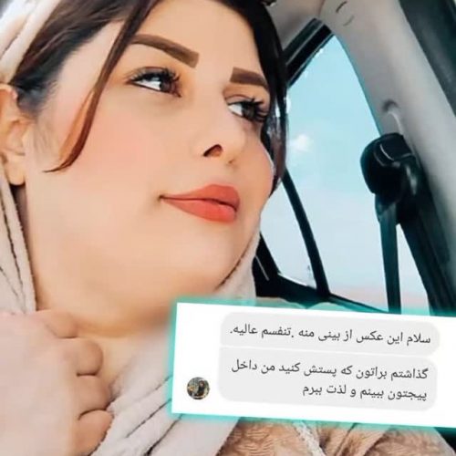جراحی-بینی-500