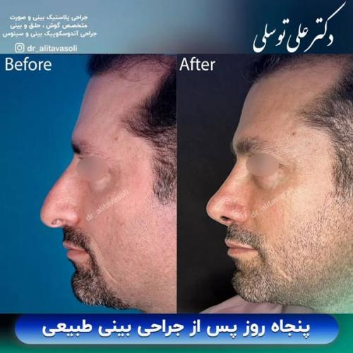 جراحی-بینی-357 (1)