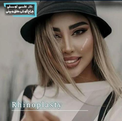 جراحی-بینی-471