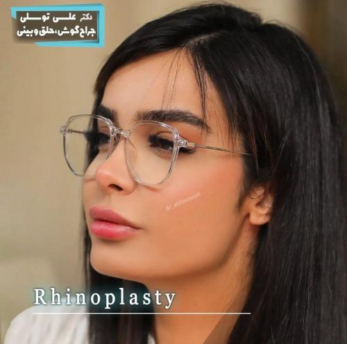 جراحی-بینی-472