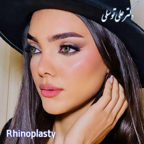 جراحی-بینی-480