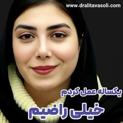 جراحی-بینی-484