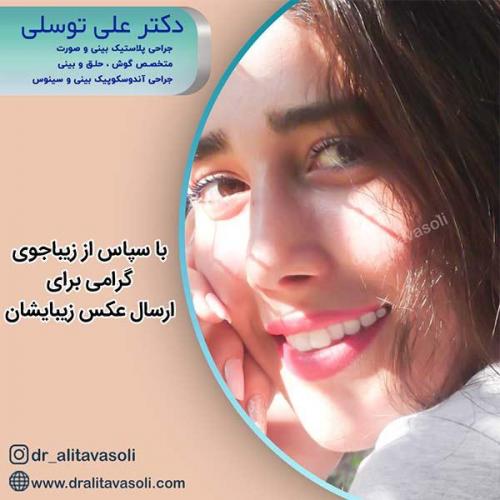 جراحی-بینی-59