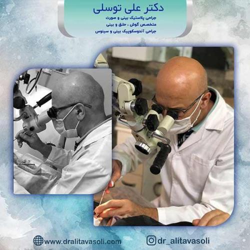 جراحی-بینی-62