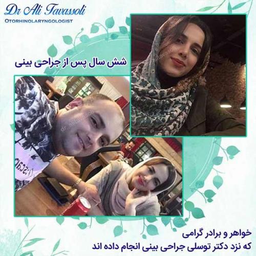جراحی-بینی-82