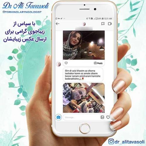 جراحی-بینی-83