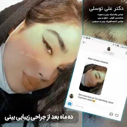 جراحی-بینی205