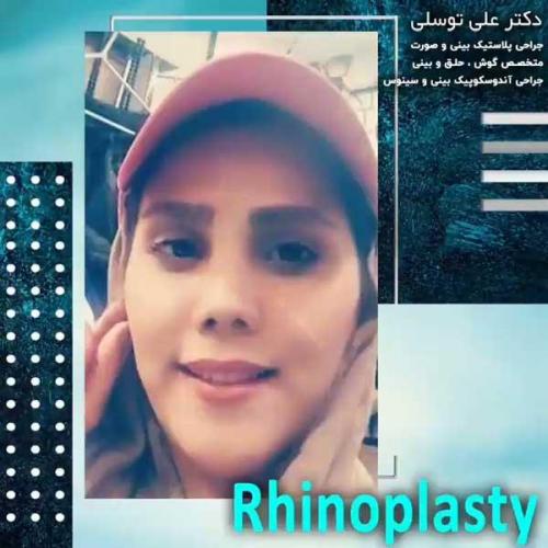 جراحی-بینی207
