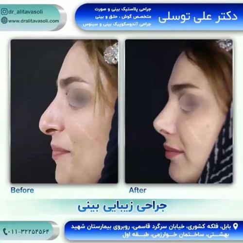 جراحی-بینی209
