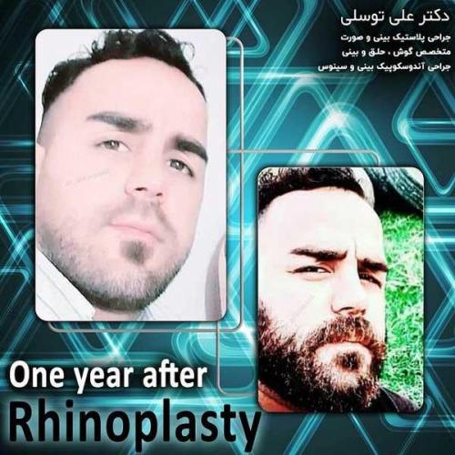 جراحی-بینی210