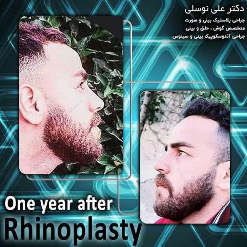 جراحی-بینی211
