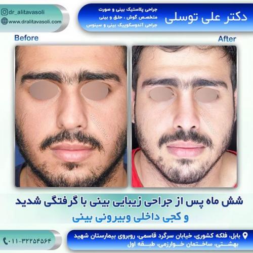 جراحی-بینی251