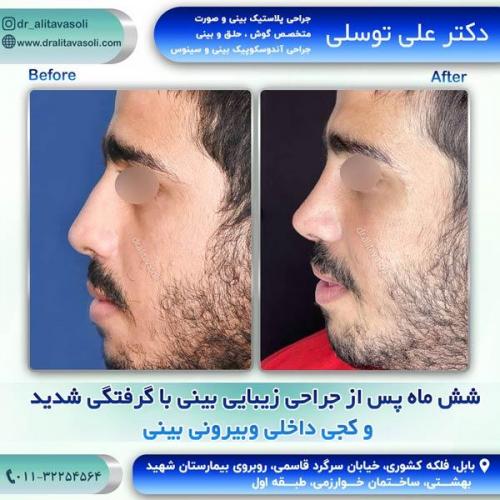 جراحی-بینی252