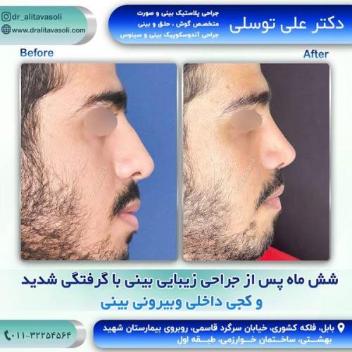 جراحی-بینی253