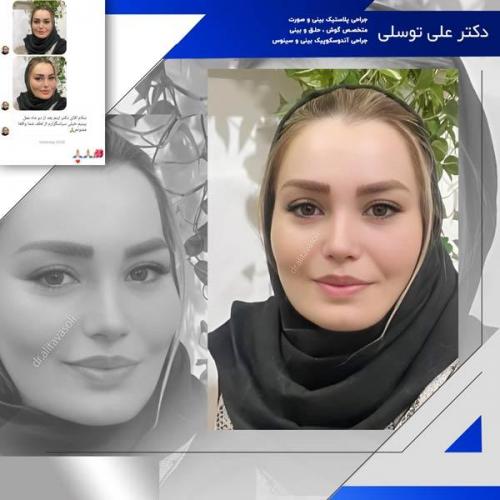 جراحی-بینی255