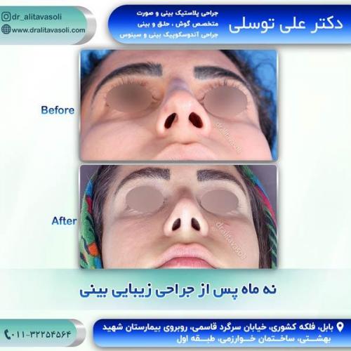 جراحی-بینی257
