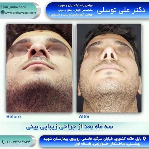 جراحی-بینی266