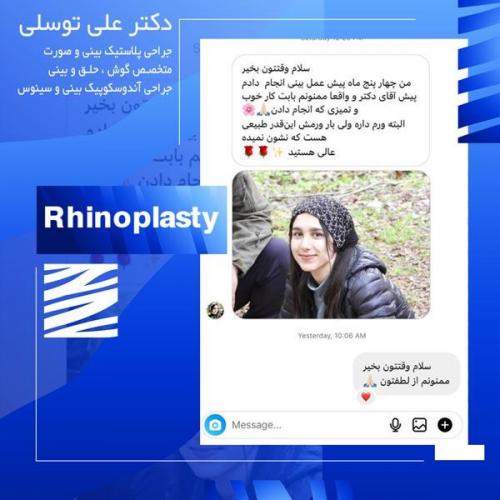 جراحی-بینی271