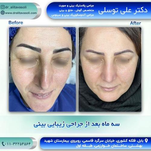 جراحی-بینی272