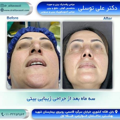جراحی-بینی273