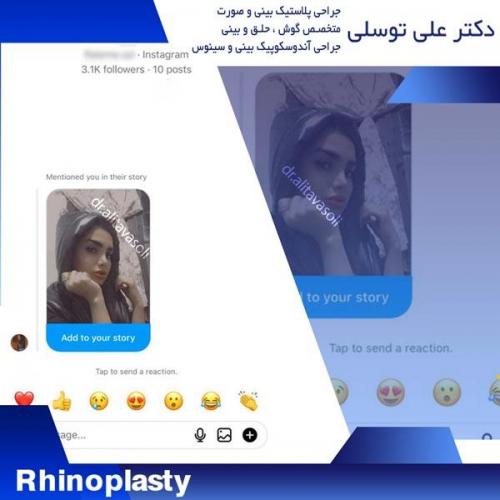 جراحی-بینی276