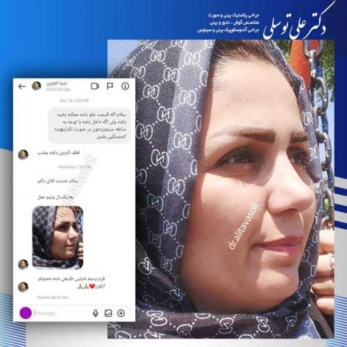 جراحی-بینی279
