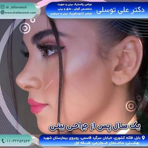 جراحی-بینی318