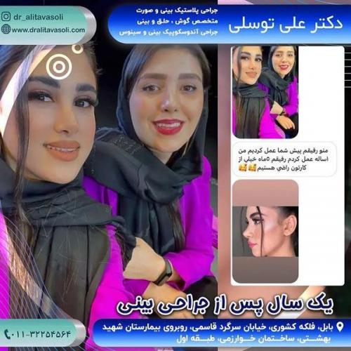 جراحی-بینی319