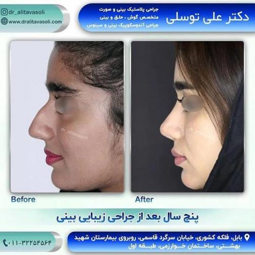 جراحی-بینی321