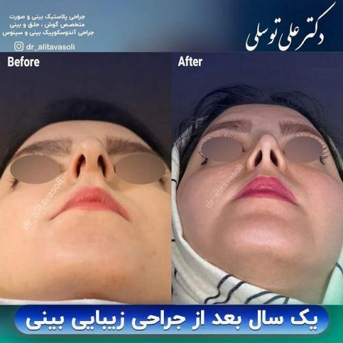جراحی-بینی325