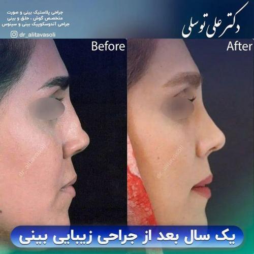 جراحی-بینی326