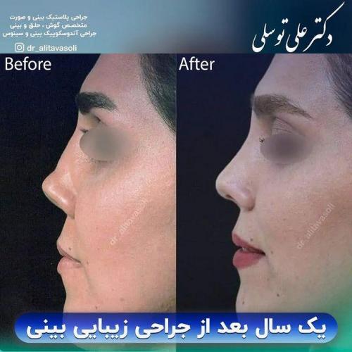 جراحی-بینی327